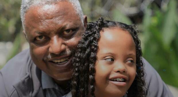 Giornata mondiale della sindrome di Down: da Roma un progetto per aiutare i bimbi etiopi