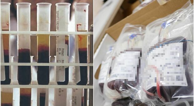 Contagiato da sangue infetto durante le trasfusioni, uomo di Rieti risarcito con 500mila euro 37 anni dopo