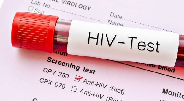 HIV: ancora disinformazione e pregiudizi tra i giovani. Così aumentano paura e rischi