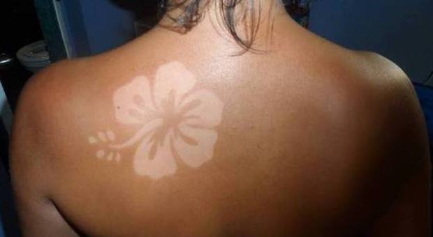 Tatuarsi con i raggi del sole: la nuova moda fa impazzire tutti. Ma occhio alla salute...