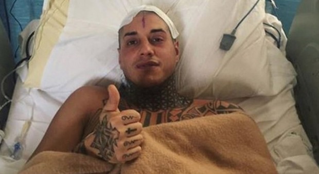 Francesco Chiofalo, la mamma di "Lenticchio" sbotta su Instagram dopo l'operazione: «Vi dovete vergognare»