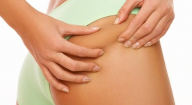 La cellulite, eterna nemica delle donne, ecco le 10 cause che la scatenano