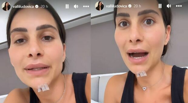 Ludovica Valli torna sui social dopo il ricovero: «Non ho ancora capito cosa mi sia successo». Ecco come sta