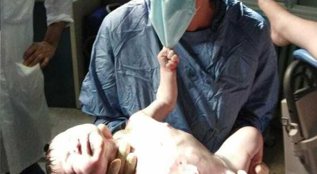 Il neonato strappa la mascherina all’ostetrica. «È stata una reazione inaspettata del bimbo»