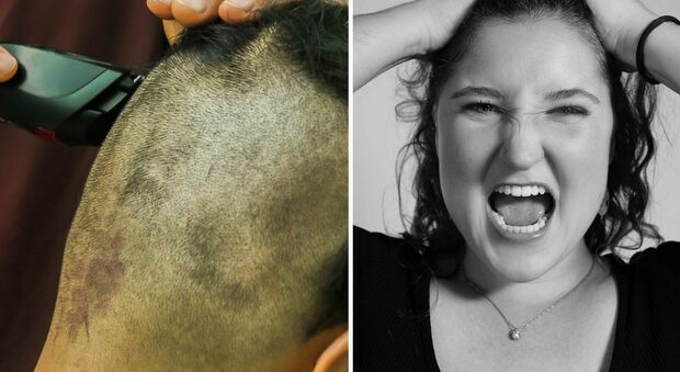 «Mio marito ha rasato una parte dei miei capelli "per scherzo" e anche se si è scusato continua a trovarlo divertente: non riesco a perdonarlo»