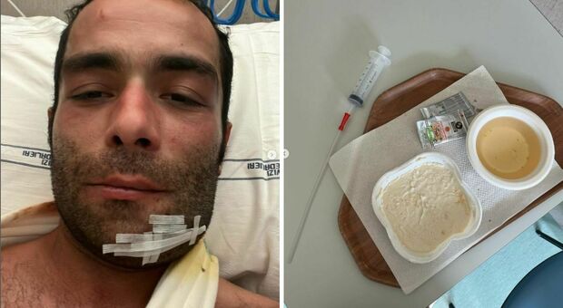 Danilo Petrucci dopo l'incidente sulla pista di motocross: «Pasta broccoli e tacchino, mai capitato di mangiare con una siringa»