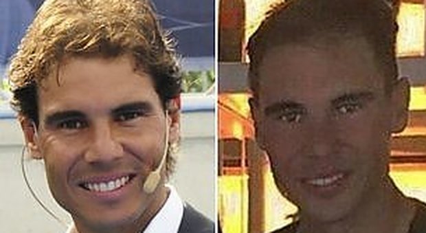 Rafa Nadal dopo il trapianto di capelli: il nuovo look del campione
