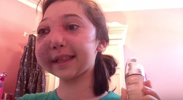 Con una malformazione del viso dà consigli sul make up. Nikki, 12 anni, è una star del web