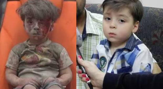 Il bimbo insanguinato di Aleppo ora sta bene. E il papà accusa: "Strumentalizzato dai ribelli"