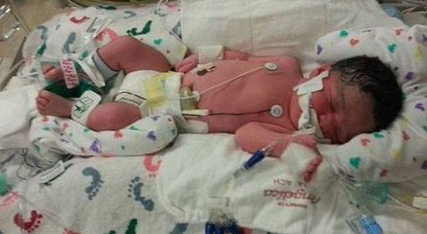 Si risveglia dal coma e dà alla luce una bambina: era stata travolta da un carro attrezzi