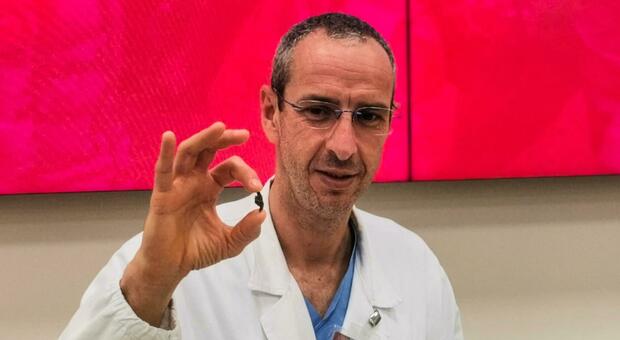 Il cardiochirurgo Vladimiro Vida, mostra la scheggia asportata vicino al cuore del bimbo