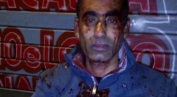 Roma, un altro bengalese picchiato a sangue: «Raid razzista»