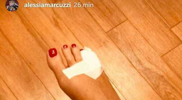 Alessia Marcuzzi si frattura il mignolo del piede, appello social a Nicola Savino