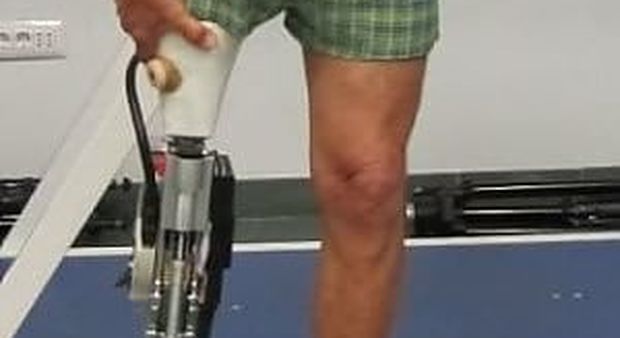 Ha perso una gamba, ma non basta per avere l'assegno di invalidità Inps