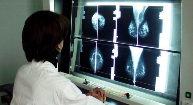 Cancro al seno, scandalo sanità: «Più di 270 donne morte per un errore del computer»