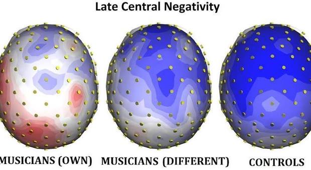 le mappe topografiche (visione dall alto) evidenziano i diversi gradi di attivazione del cervello in musicisti che ascoltano il proprio strumento, musicisti che ascoltano un altro strumento musicale e non-musicisti, 1100-1400 millisecondi dopo l inizi