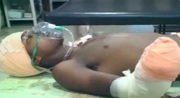 India, padre taglia le mani del 17enne che ha violentato la figlia di 7 mesi