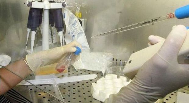 Ricercatori di Napoli trovano il modo di bloccare proteina che favorisce i tumori