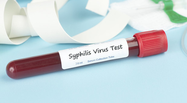 Sifilide, boom di nuovi casi in Europa: +70% in dieci anni