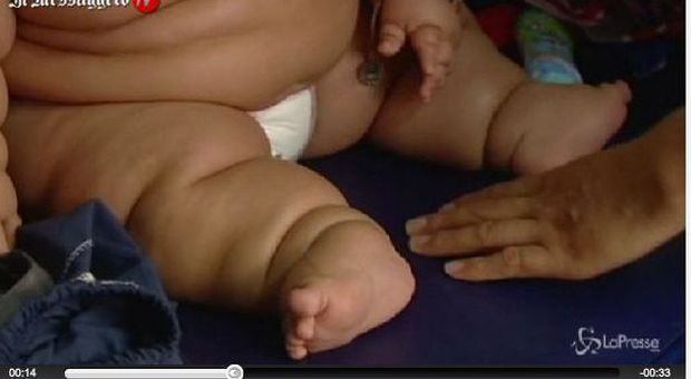 Colombia, bimbo di 8 mesi pesa già 20 chili