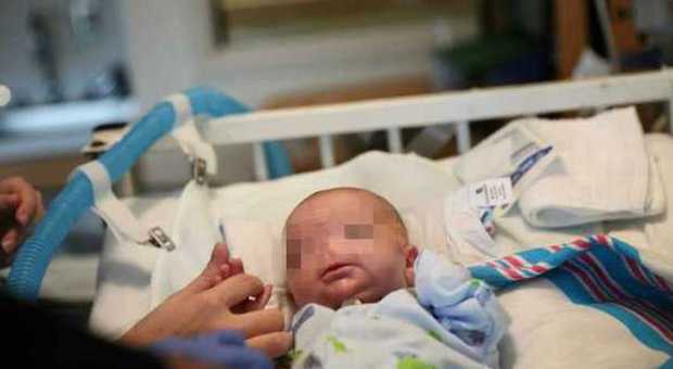 Timothy Eli Thompson, la bimba nata senza naso (Metro)