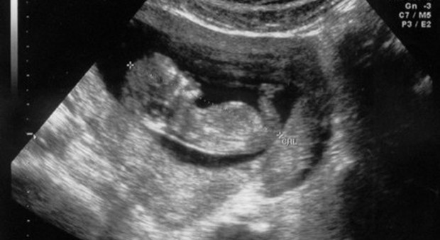 Donna incinta al quinto mese mette in vendita il figlio all'asta su Facebook: prezzo base 10mila euro