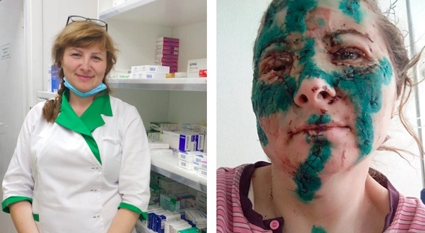 La farmacista Nina Oleksandrivna Zhuk prima e dopo essere stata ferita nei bombardamenti