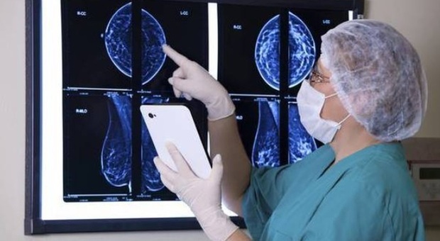 Tumore al seno, un algoritmo prevede la risposta alle terapie ormonali