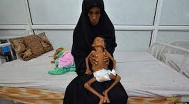 La guerra nello Yemen dell'Arabia Saudita finora è costata la vita a 85 mila bambini