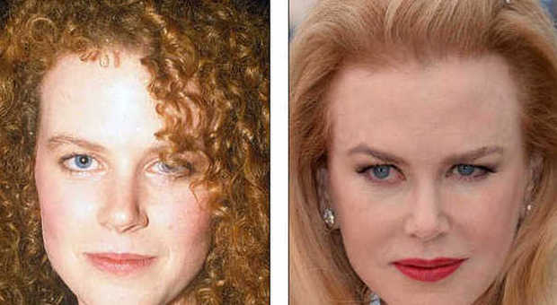 Ecco come è diventata Nicole Kidman