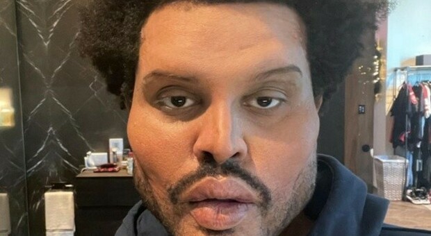 The Weeknd, foto inquietante su Instagram. Fan preoccupati: «Ma cosa succede?». Ecco la verità