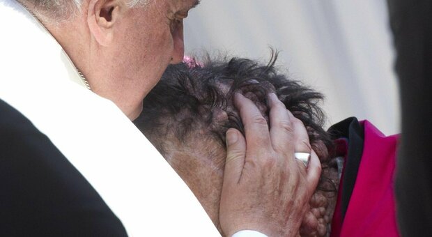 Morto Vinicio Riva, venne abbracciato dal Papa. Era affetto da una malattia deformante al volto. Cos'è il morbo di von Recklinghause