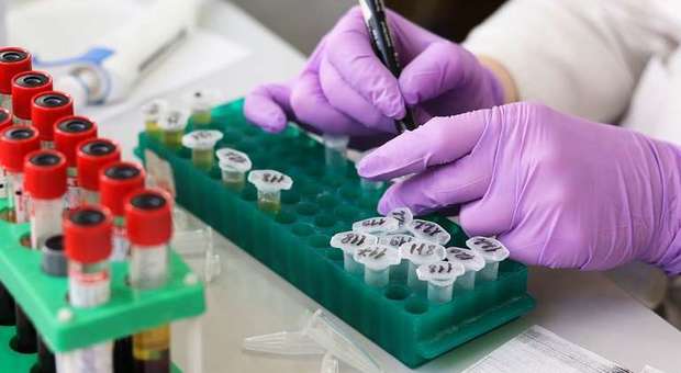 Coronavirus, test sierologico su 5.500 persone in Abruzzo
