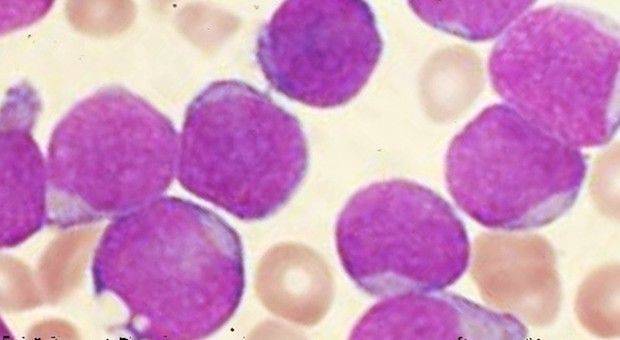 Le super-cellule che uccidono il cancro "scudo" anche dopo 14 anni
