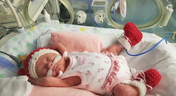 Matilda nasce con tre mesi d'anticipo, metre i genitori inglesi sono in vacanza a Trento: gara di solidarietà per aiutarla