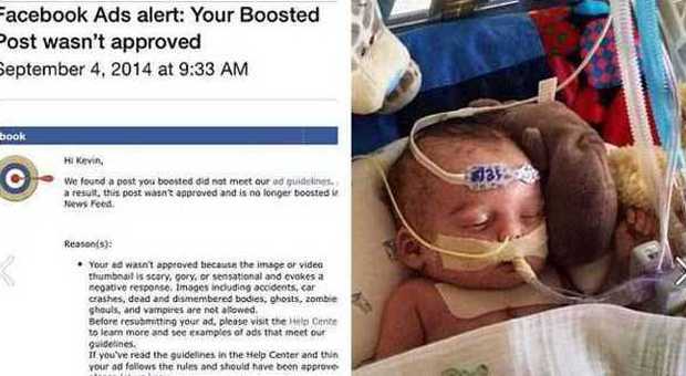Il bimbo è malato e ha bisogno di un trapianto: Facebook "banna" la pagina di raccolta fondi