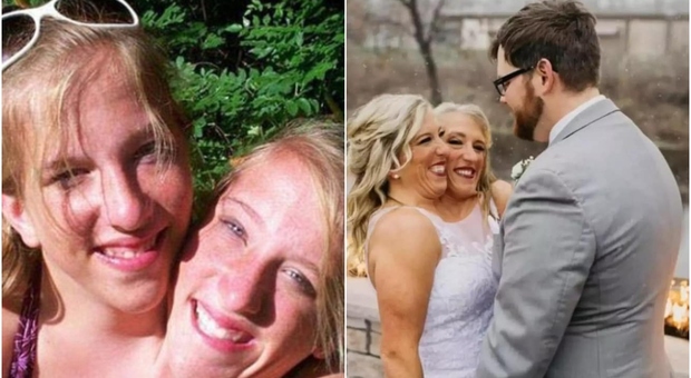 Gemelle siamesi, Abby Hensel si è sposata: il video sui social è virale. «Non escludiamo la possibilità di avere figli»