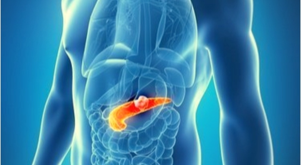 Tumore al pancreas, nuova cura americana elimina il cancro in oltre il 20% dei casi