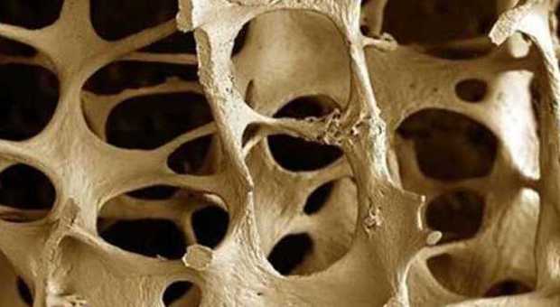 Osteoporosi e dolore cronico: esperti ne parlano a Santa Chiara