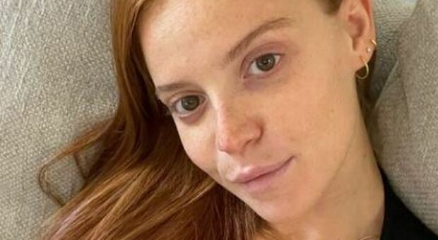 Ludovica Bizzaglia: «Ho avuto la pericardite, ma vaccinatevi». L'attrice attaccata dai No vax