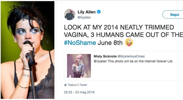 Lily Allen e la foto hard sul palco: «Perfettamente depilata, da lì sono usciti tre umani»