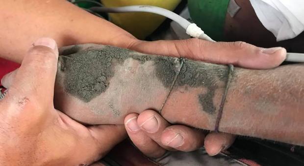 Chiara, salvata dal fango a 8 anni: i genitori sono morti nella piena del torrente Raganello