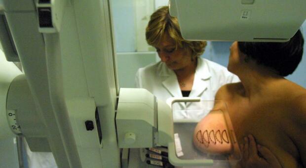 Tumore al seno: un nuovo farmaco riduce il rischio di morte