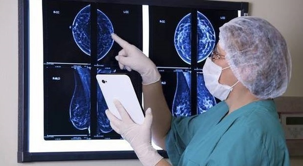 Tumore al seno curato senza chemio, a Monza lo studio sperimentale