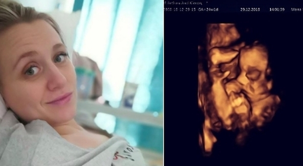 Estraggono il feto, lo operano e lo rimettono nella pancia: mamma e figlio stanno bene
