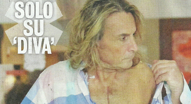 Marco Firpo, il cavaliere di "Uomini e donne" dopo l'operazione al cuore