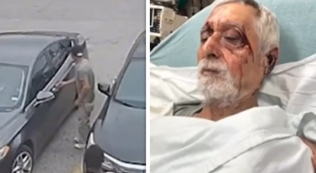 Malato di Alzheimer prova a entrare nell'auto sbagliata, picchiato a sangue dai proprietari e abbandonato nel parcheggio