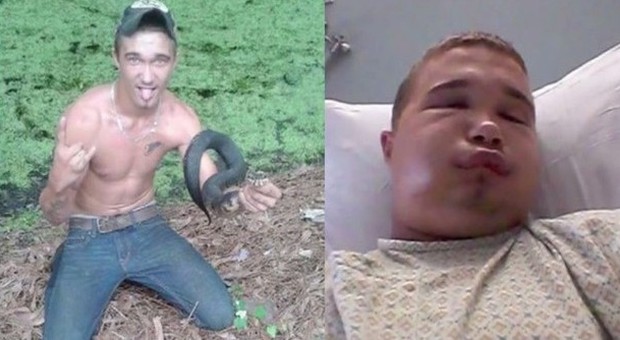 Florida, prova a baciare un serpente: la reazione del crotalo lo manda all'ospedale