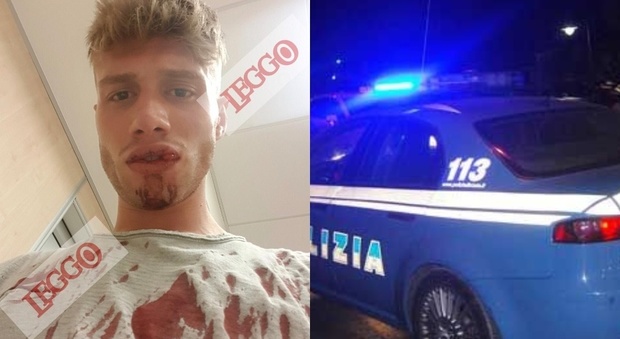 Roma, la denuncia choc di Marco: «Picchiato a sangue in strada da un poliziotto in borghese»