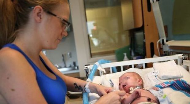 Bimbo nato senza naso, Facebook rimuove le foto del piccolo: "Contenuto offensivo"